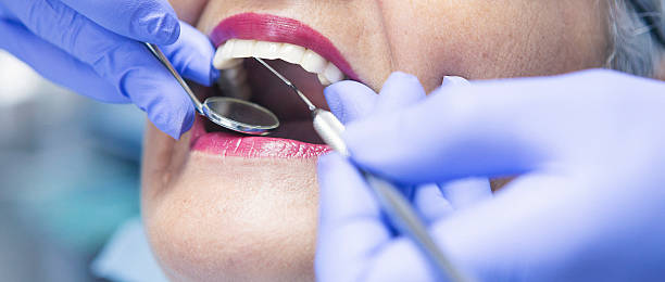 Best Emergency Wisdom Teeth Removal in Pierson, FL